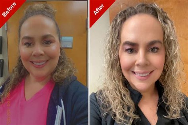 Before And After Of Janaina Prazeres Plastic Surgery